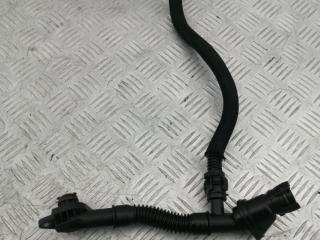 трубка вентиляции картерных газов BMW 5 серия F07/F10/F11 [рестайлинг] F10 2013, 4.4 л., N63 B44 A, бензин, АКПП, черный black-sapphire metallic, седан, полный привод, 11157646086